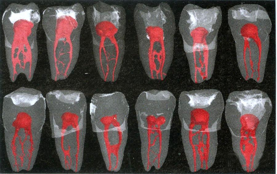 Imagem de vários dentes, mostrando a complexidade dos sistemas de canais radiculares.